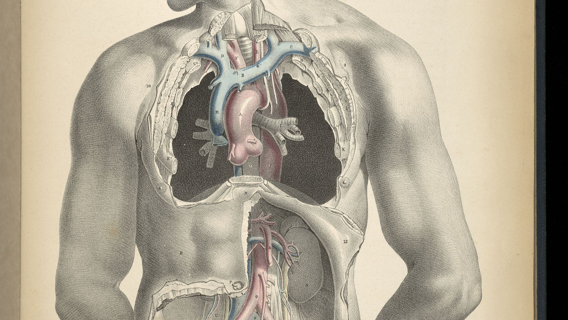 Sinclair, Thomas after Joseph Maclise